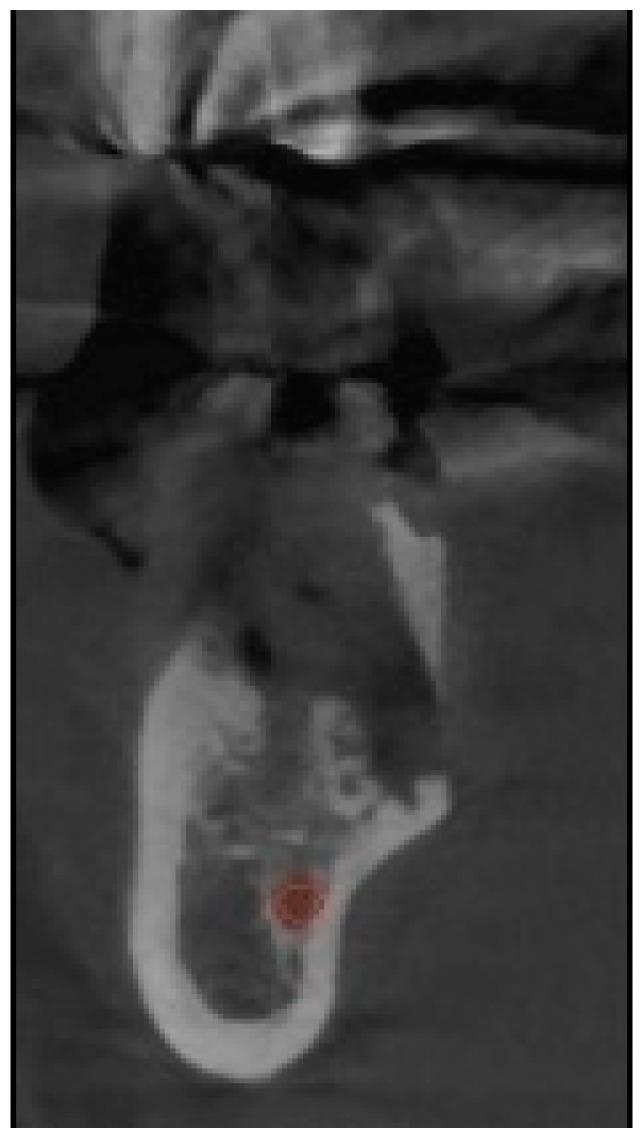 https://cdn.ncbi.nlm.nih.gov/pmc/blobs/ad4e/11353795/9d6bc960d61e/diagnostics-14-01792-g001.jpg