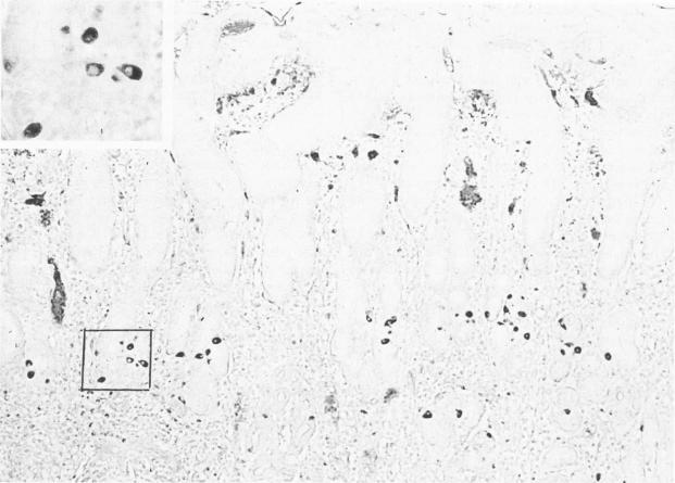 https://cdn.ncbi.nlm.nih.gov/pmc/blobs/ad53/1900475/2277121e75a5/amjpathol00180-0040-a.jpg