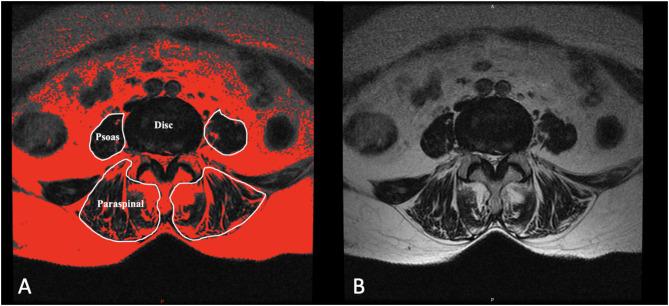 https://cdn.ncbi.nlm.nih.gov/pmc/blobs/ad56/12334732/d7bbbb541d85/41598_2025_14986_Fig1_HTML.jpg