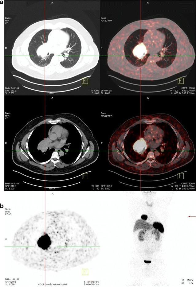 https://cdn.ncbi.nlm.nih.gov/pmc/blobs/ad58/4924317/1c9f01611724/13104_2016_2132_Fig2_HTML.jpg