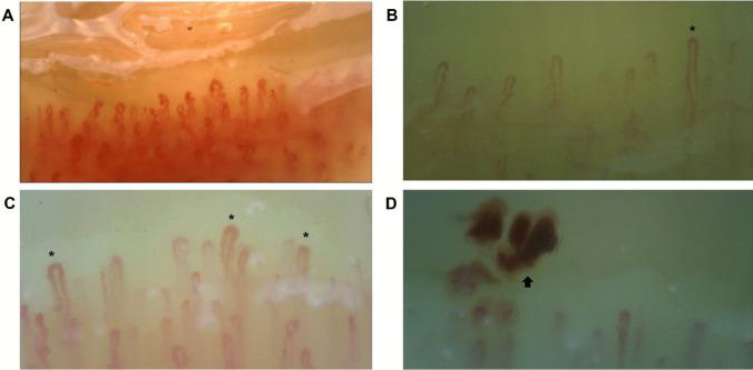 https://cdn.ncbi.nlm.nih.gov/pmc/blobs/ad62/11564348/6b35e4f01ed4/12026_2024_9501_Fig4_HTML.jpg