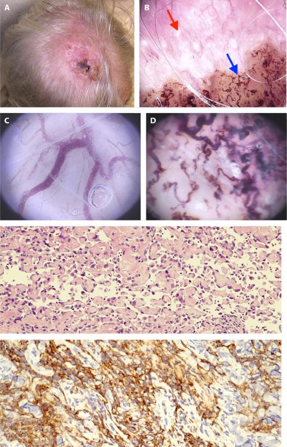 https://cdn.ncbi.nlm.nih.gov/pmc/blobs/ad63/12339127/21d63f7ede13/dp1503a5296g001.jpg
