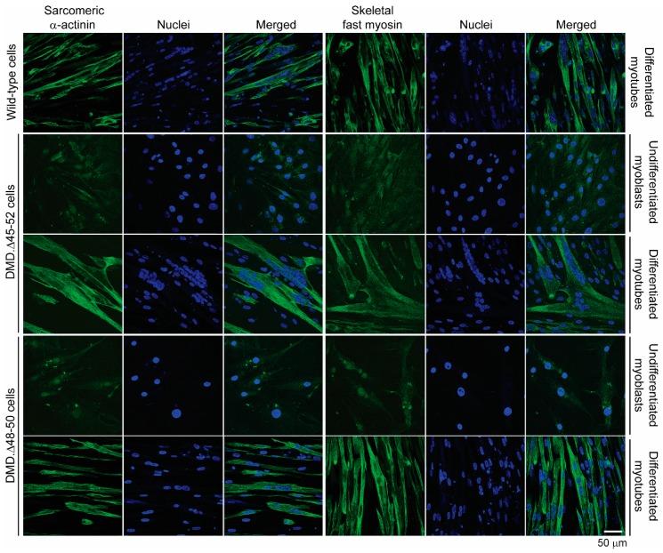 https://cdn.ncbi.nlm.nih.gov/pmc/blobs/ad65/7226760/536dfa0c58e9/cells-09-00869-g006.jpg