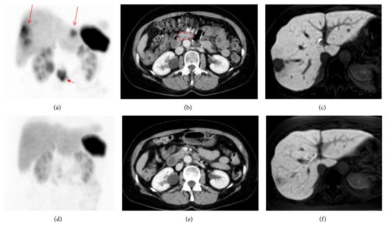 https://cdn.ncbi.nlm.nih.gov/pmc/blobs/ad66/4387942/3abd1f2a9398/BMRI2015-917968.004.jpg