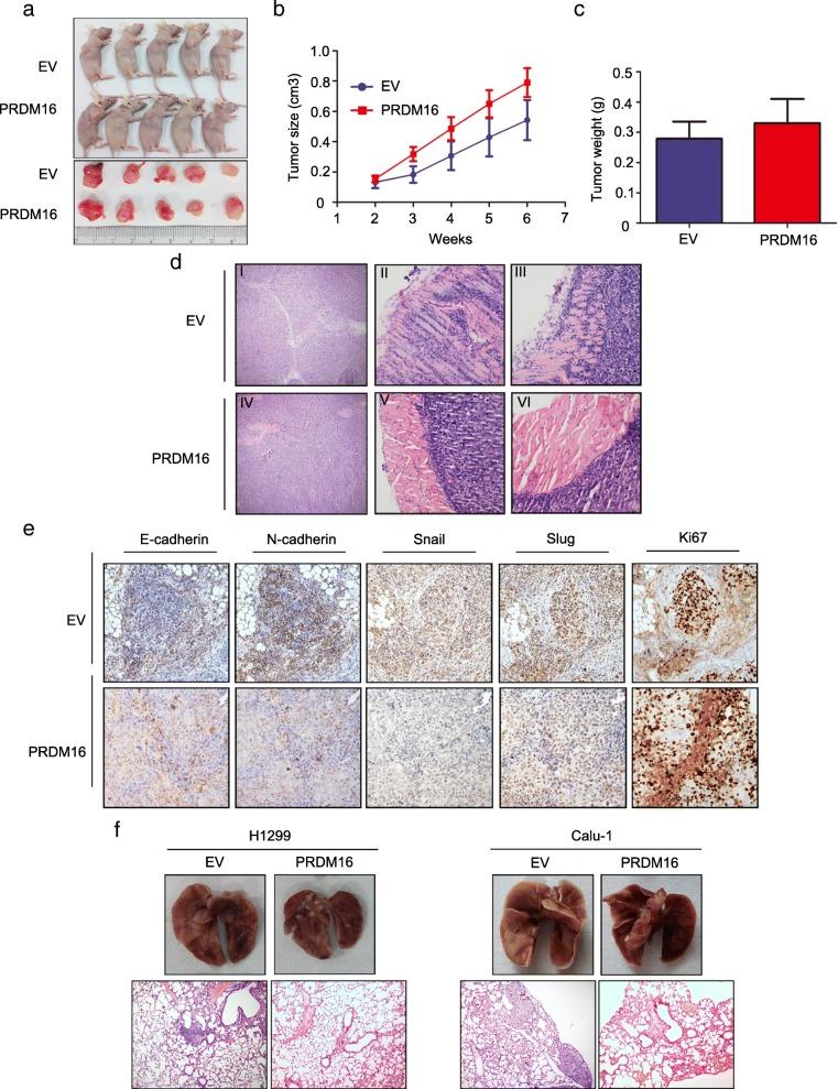 https://cdn.ncbi.nlm.nih.gov/pmc/blobs/ad78/6347838/3aee335aa57f/13046_2019_1042_Fig4_HTML.jpg