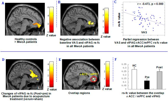 https://cdn.ncbi.nlm.nih.gov/pmc/blobs/ad7a/4738255/3442cd050aa0/srep20298-f3.jpg