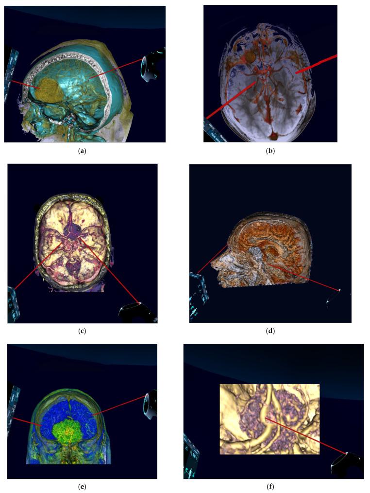 https://cdn.ncbi.nlm.nih.gov/pmc/blobs/ad7c/7916569/2ca864669f5c/jcm-10-00681-g004a.jpg