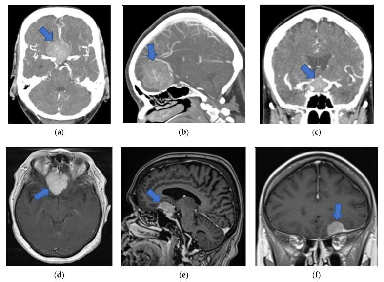 https://cdn.ncbi.nlm.nih.gov/pmc/blobs/ad7c/7916569/759ab7ea1d18/jcm-10-00681-g002a.jpg