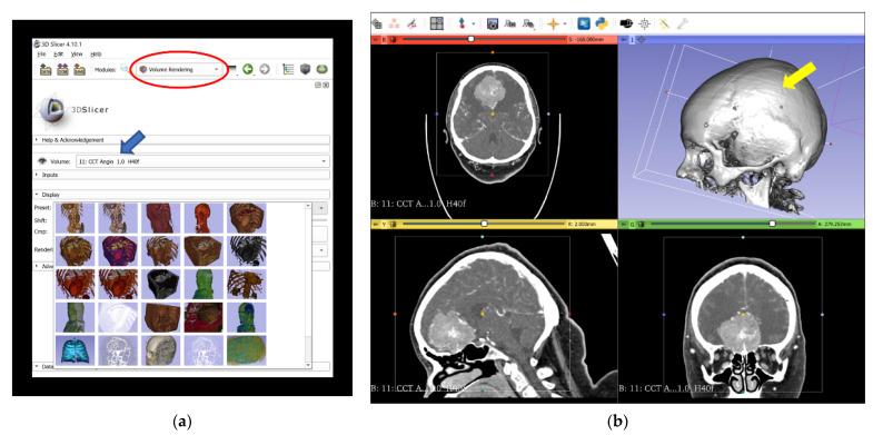 https://cdn.ncbi.nlm.nih.gov/pmc/blobs/ad7c/7916569/9739c2be585a/jcm-10-00681-g001a.jpg