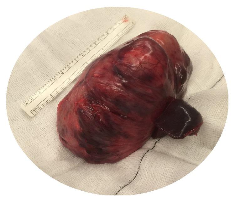 https://cdn.ncbi.nlm.nih.gov/pmc/blobs/ad80/4697093/019c4e1a722a/CRIPA2015-209490.002.jpg
