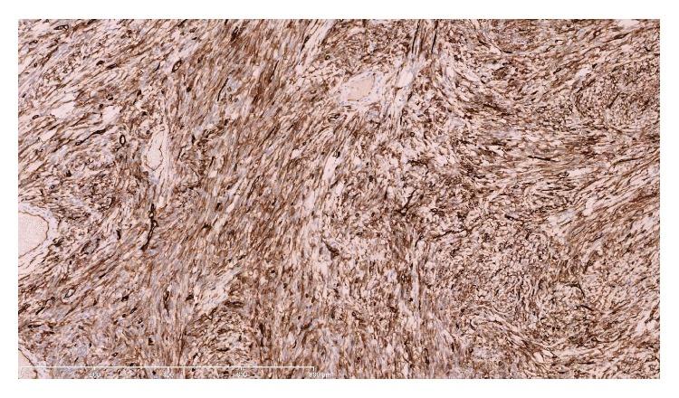 https://cdn.ncbi.nlm.nih.gov/pmc/blobs/ad80/4697093/0996ac72cae9/CRIPA2015-209490.003.jpg