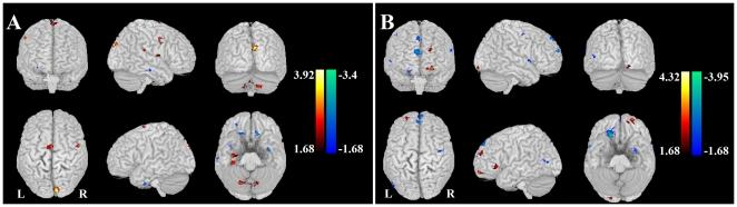 https://cdn.ncbi.nlm.nih.gov/pmc/blobs/ad82/3008679/91be652c7278/pone.0015238.g002.jpg