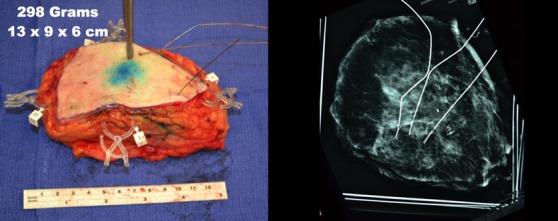 https://cdn.ncbi.nlm.nih.gov/pmc/blobs/ad88/4303932/125fdf65ac26/tbj0021-0052-f12.jpg