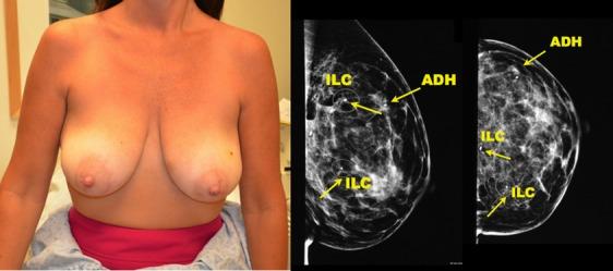 https://cdn.ncbi.nlm.nih.gov/pmc/blobs/ad88/4303932/91f87a39c6c5/tbj0021-0052-f5.jpg