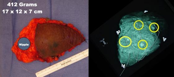 https://cdn.ncbi.nlm.nih.gov/pmc/blobs/ad88/4303932/e647c2b4d53a/tbj0021-0052-f3.jpg