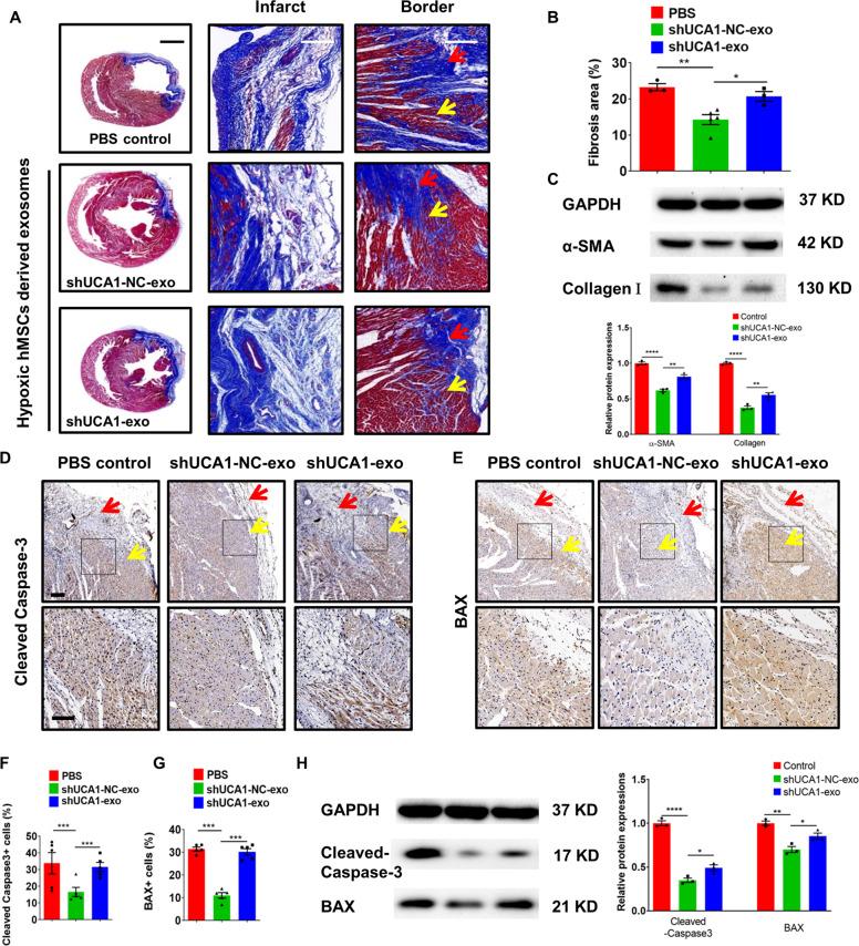 https://cdn.ncbi.nlm.nih.gov/pmc/blobs/ad8b/7442657/1cf8d2757956/41419_2020_2783_Fig5_HTML.jpg