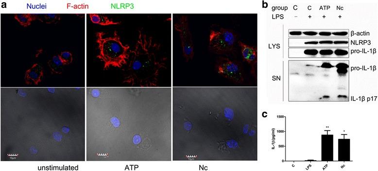 https://cdn.ncbi.nlm.nih.gov/pmc/blobs/ad90/5450200/3b255be1a5a7/13071_2017_2197_Fig4_HTML.jpg