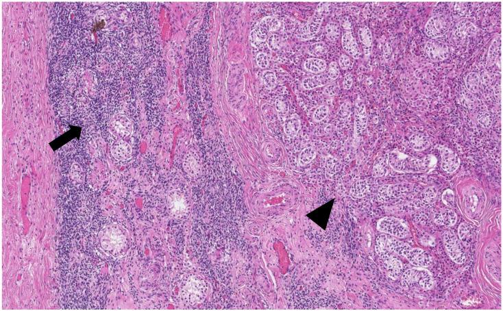 https://cdn.ncbi.nlm.nih.gov/pmc/blobs/ad96/9787768/78670da16d90/medicina-58-01736-g004.jpg