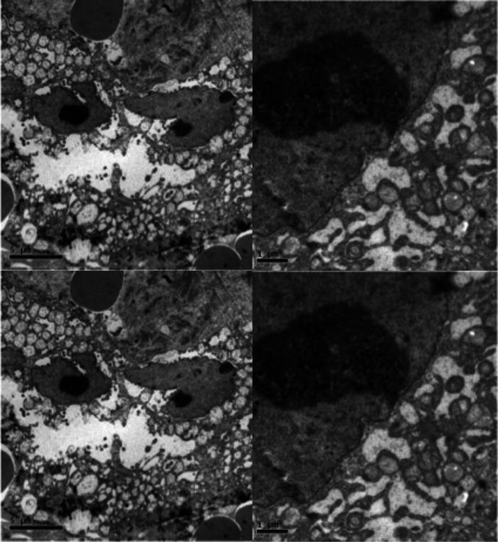 https://cdn.ncbi.nlm.nih.gov/pmc/blobs/ad98/9498185/69b59c984a21/fmedt-04-869155-g003.jpg