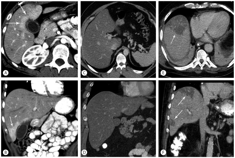 https://cdn.ncbi.nlm.nih.gov/pmc/blobs/ada0/4197183/e8901da57443/cmh-20-317-g005.jpg