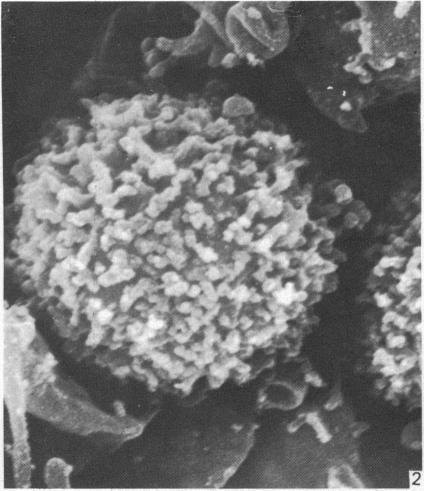 https://cdn.ncbi.nlm.nih.gov/pmc/blobs/ada2/1165139/fd0fe8c925db/janat00193-0099-a.jpg