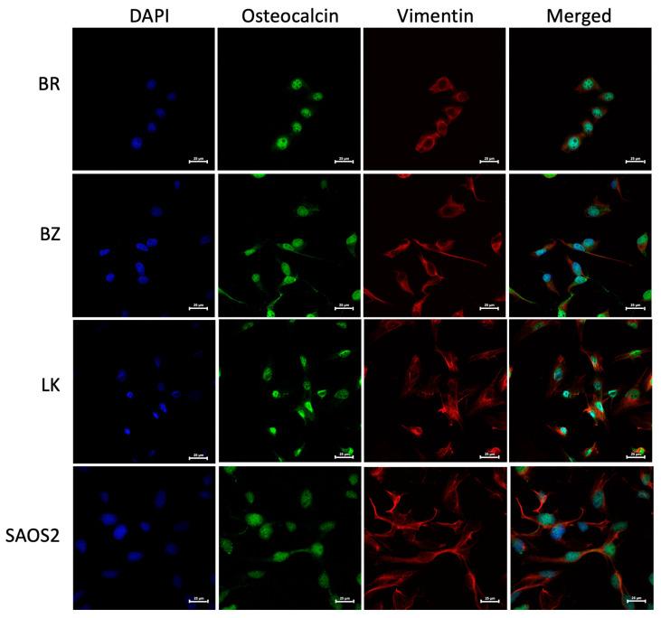 https://cdn.ncbi.nlm.nih.gov/pmc/blobs/adad/10778184/e3ea58175e41/cells-13-00025-g002.jpg