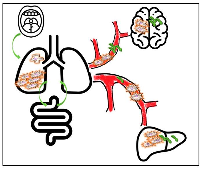 https://cdn.ncbi.nlm.nih.gov/pmc/blobs/adad/9264919/4375191ec985/cancers-14-03131-g001.jpg