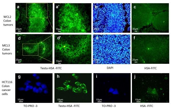 https://cdn.ncbi.nlm.nih.gov/pmc/blobs/adc4/2794856/8863426387d1/1476-4598-8-114-1.jpg