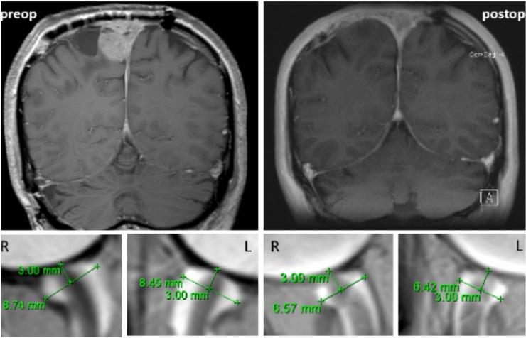 https://cdn.ncbi.nlm.nih.gov/pmc/blobs/adc7/12358562/7882b9c43900/41598_2025_11856_Fig1_HTML.jpg