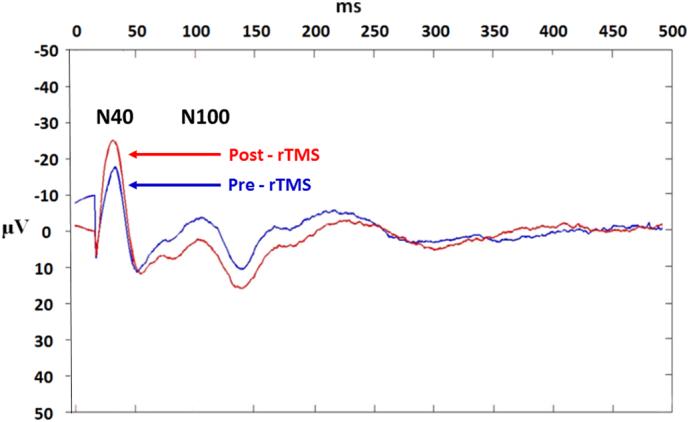 https://cdn.ncbi.nlm.nih.gov/pmc/blobs/adcf/6031434/7e45aa63efe4/gr3.jpg