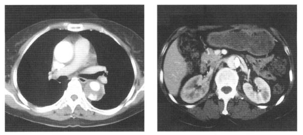 https://cdn.ncbi.nlm.nih.gov/pmc/blobs/add6/4531585/343607861ca2/kjim-19-2-134-13f1.jpg