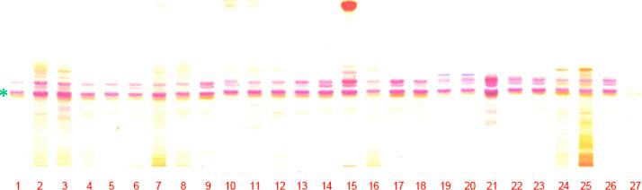 https://cdn.ncbi.nlm.nih.gov/pmc/blobs/add9/5761125/e337fa2b9aec/gr6.jpg