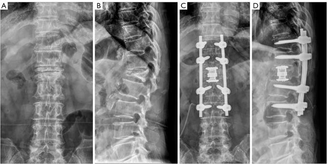 https://cdn.ncbi.nlm.nih.gov/pmc/blobs/addb/11998046/0fc2d68fd6c7/jss-11-01-104-f3.jpg