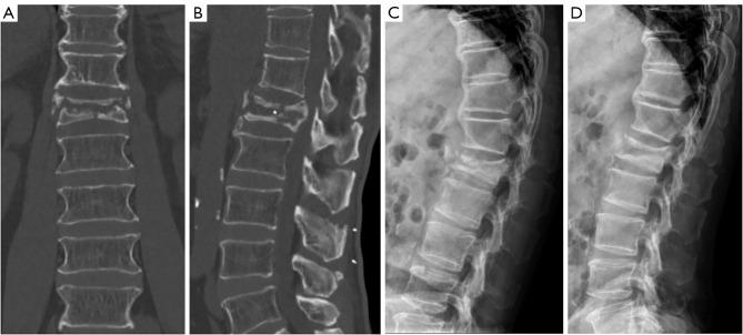 https://cdn.ncbi.nlm.nih.gov/pmc/blobs/addb/11998046/e9f94e4fc215/jss-11-01-104-f1.jpg