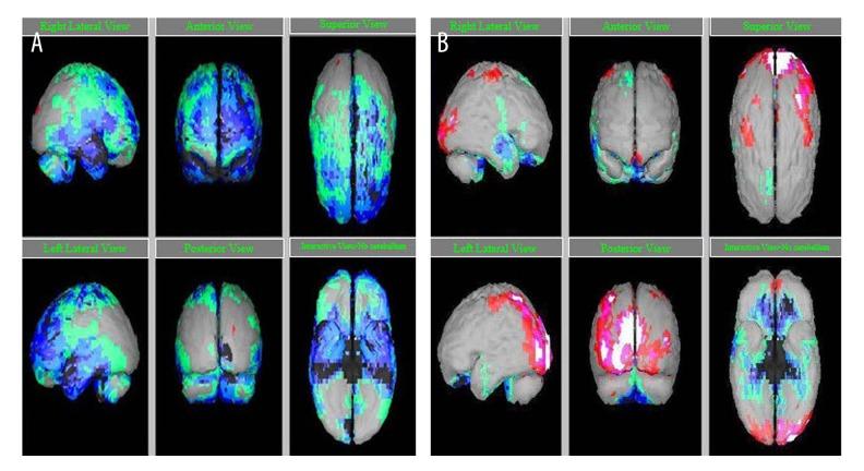 https://cdn.ncbi.nlm.nih.gov/pmc/blobs/addb/5156555/0ff2af3c8d5e/amjcaserep-17-944-g001.jpg