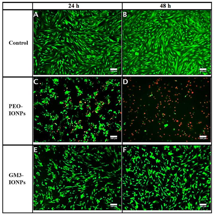 https://cdn.ncbi.nlm.nih.gov/pmc/blobs/addc/8537094/5f87de1055a9/nanomaterials-11-02465-g003.jpg