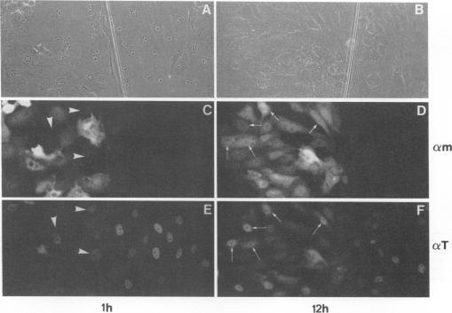 https://cdn.ncbi.nlm.nih.gov/pmc/blobs/ade0/237344/c767067ec0df/jvirol00022-0147-a.jpg
