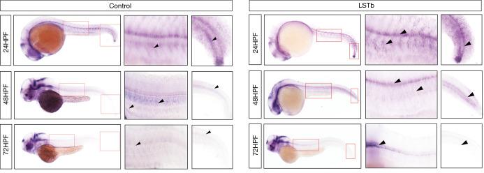 https://cdn.ncbi.nlm.nih.gov/pmc/blobs/ade1/11319995/612311a8fac0/tp-13-07-1201-f4.jpg