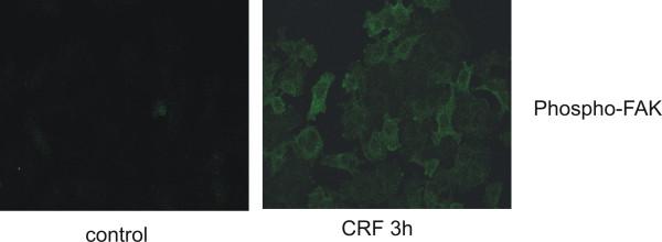https://cdn.ncbi.nlm.nih.gov/pmc/blobs/ade3/2697132/d544ac0f01d4/1476-4598-8-30-6.jpg