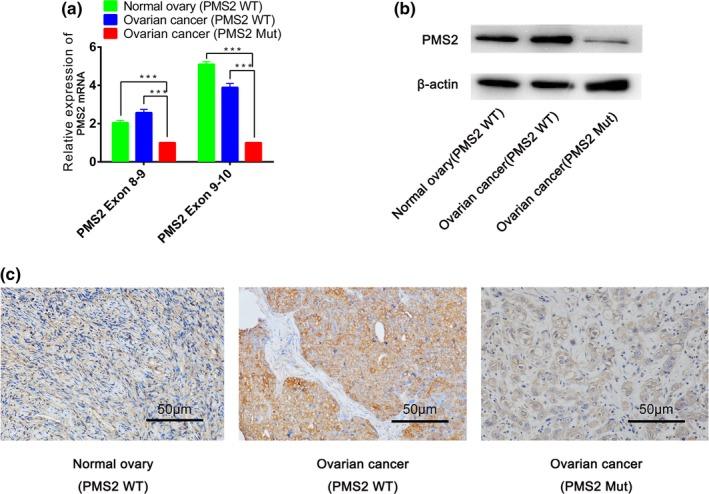 https://cdn.ncbi.nlm.nih.gov/pmc/blobs/ade9/6565568/85f848652577/MGG3-7-e721-g003.jpg
