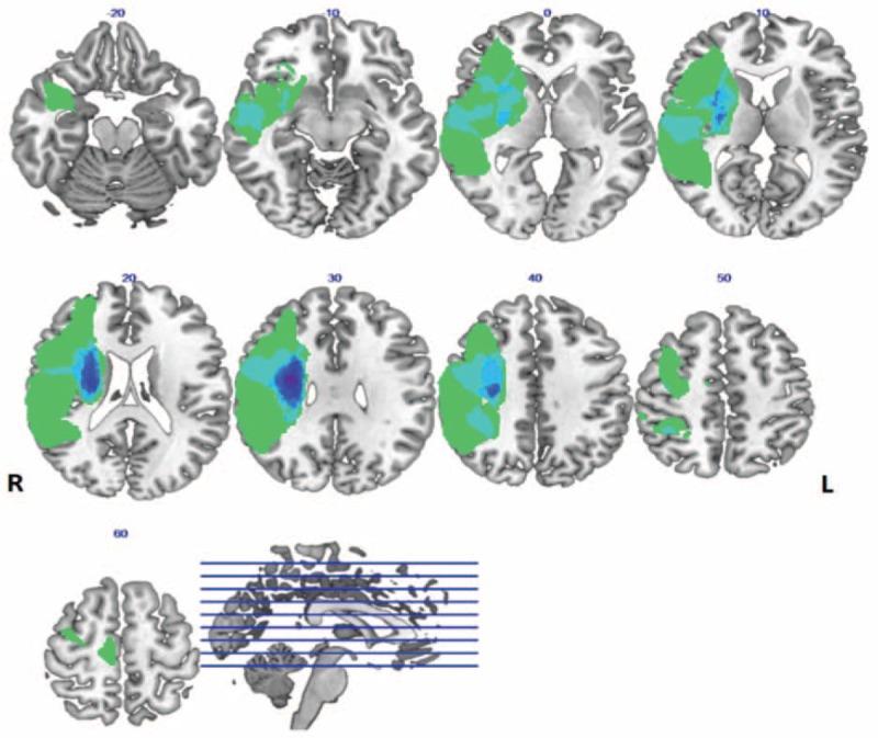 https://cdn.ncbi.nlm.nih.gov/pmc/blobs/adeb/5709020/57f4ca7edf42/medi-96-e8897-g002.jpg