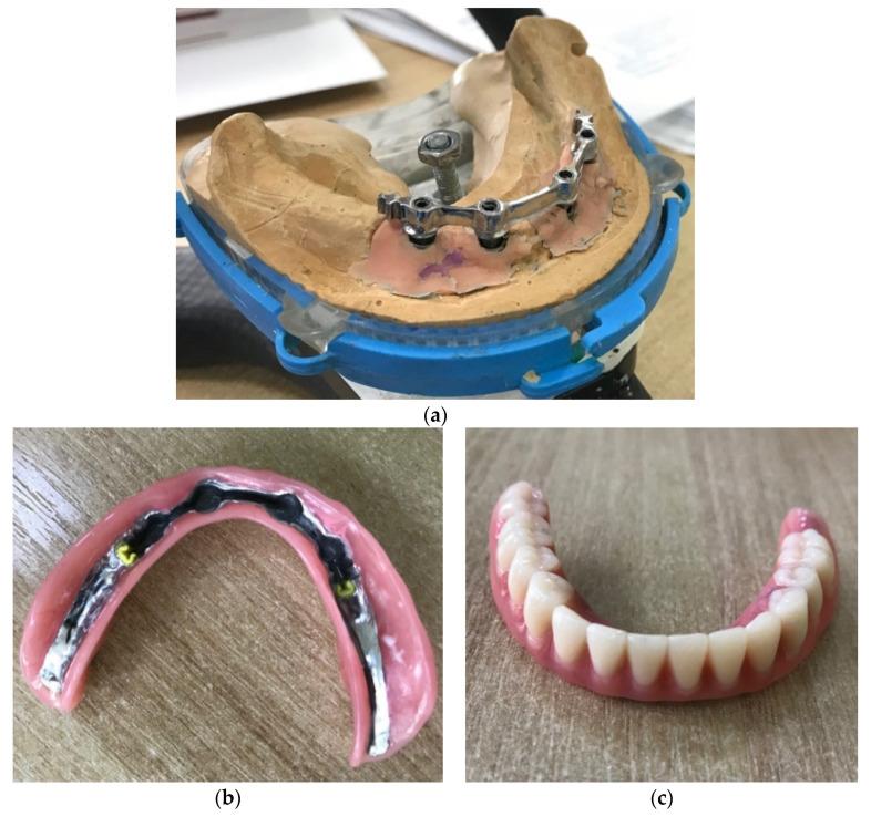 https://cdn.ncbi.nlm.nih.gov/pmc/blobs/adec/8999531/f58eaceda31c/materials-15-02398-g002.jpg