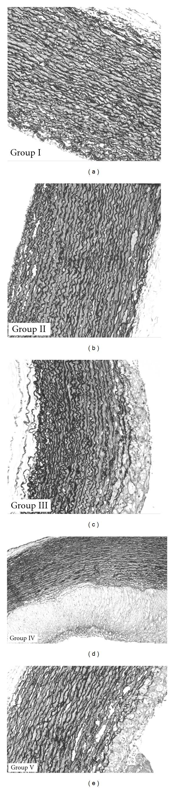 https://cdn.ncbi.nlm.nih.gov/pmc/blobs/aded/3136749/18b3b64c197f/ECAM2011-620319.006.jpg