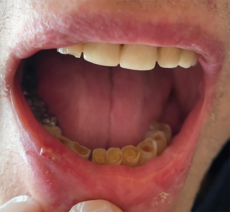 https://cdn.ncbi.nlm.nih.gov/pmc/blobs/adf1/11071011/113865918247/acr-08-23-158-f4.jpg