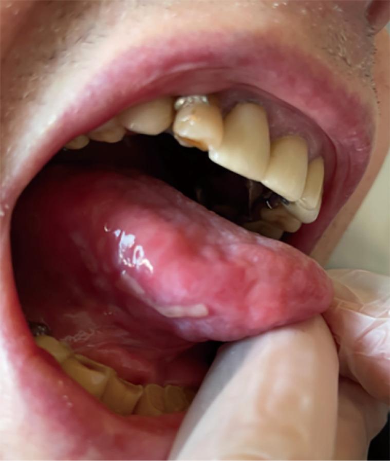 https://cdn.ncbi.nlm.nih.gov/pmc/blobs/adf1/11071011/4a1b98496533/acr-08-23-158-f3.jpg