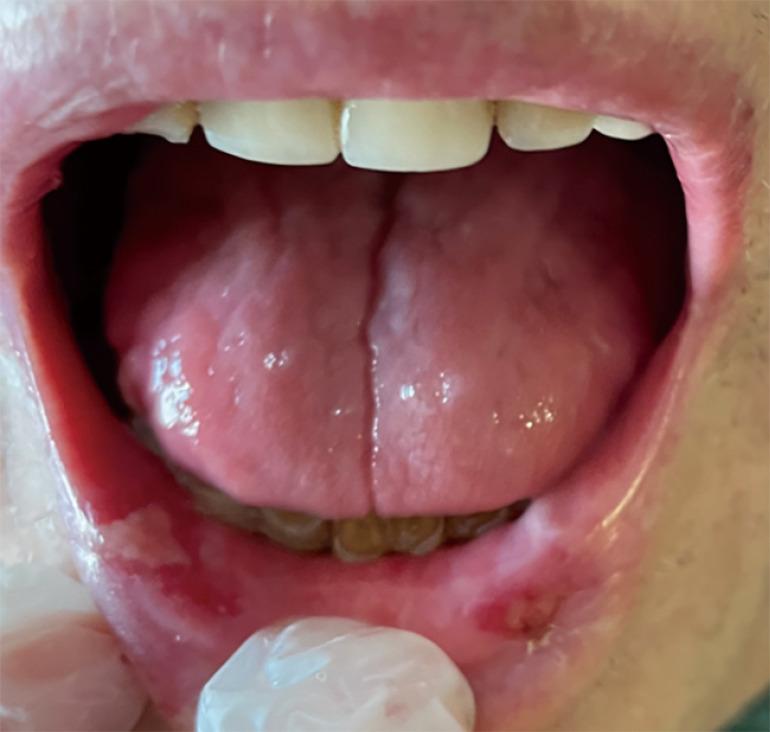 https://cdn.ncbi.nlm.nih.gov/pmc/blobs/adf1/11071011/88076942205c/acr-08-23-158-f2.jpg