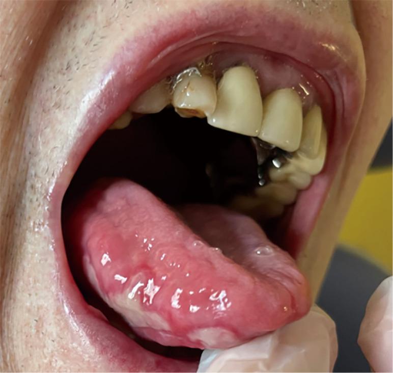 https://cdn.ncbi.nlm.nih.gov/pmc/blobs/adf1/11071011/cbbe3a23871c/acr-08-23-158-f1.jpg