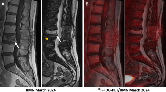 https://cdn.ncbi.nlm.nih.gov/pmc/blobs/adf7/11440879/587b15a8a115/fnume-04-1402552-g005.jpg