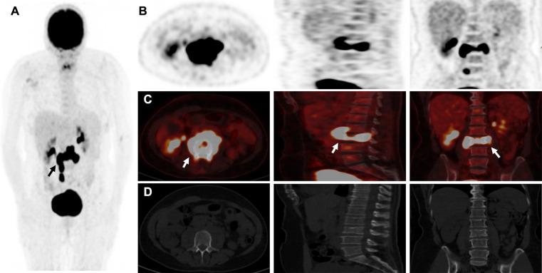 https://cdn.ncbi.nlm.nih.gov/pmc/blobs/adf7/11440879/ed905277d67e/fnume-04-1402552-g002.jpg