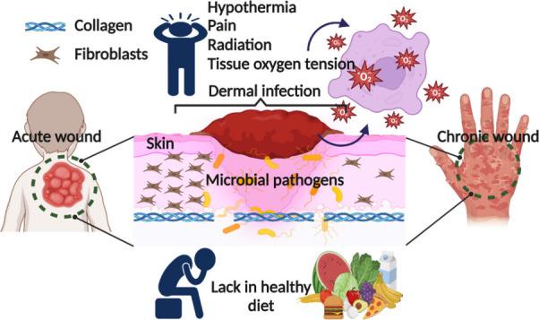 https://cdn.ncbi.nlm.nih.gov/pmc/blobs/ae09/11986729/5f07d1d95c4b/lg4c00092_0001.jpg